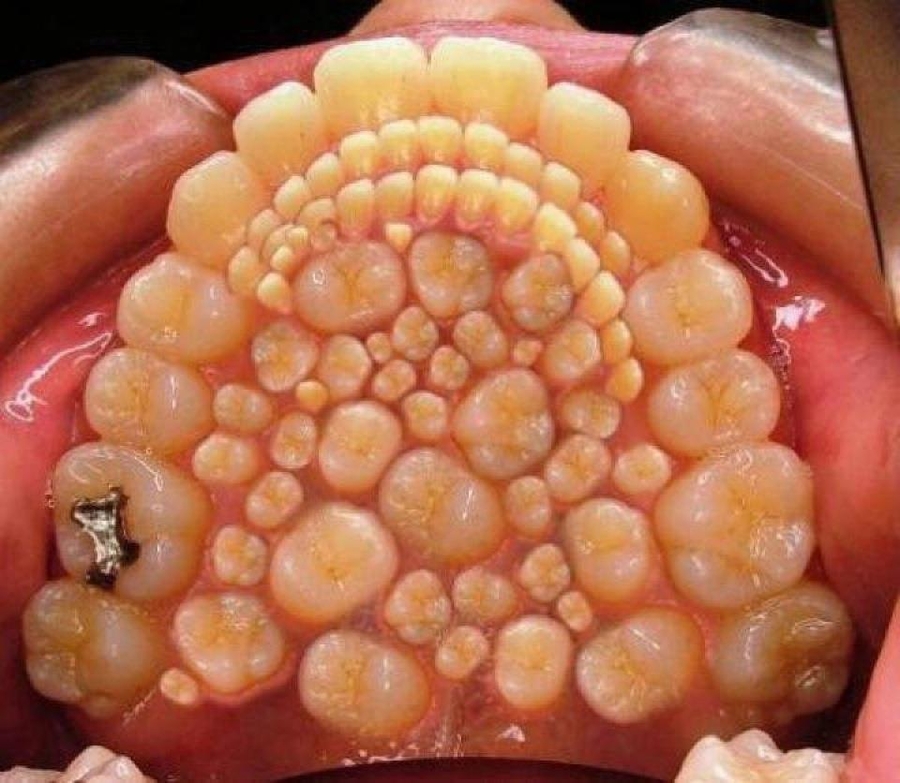 tyleroakley my worst hook up ever